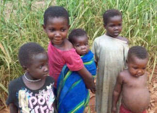 Micronutrient deficiency now persist in Nigerian children -CS-SUNN