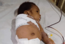 Father breaks the arm of his 2-month-old baby in Imo
