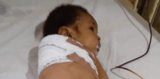 Father breaks the arm of his 2-month-old baby in Imo