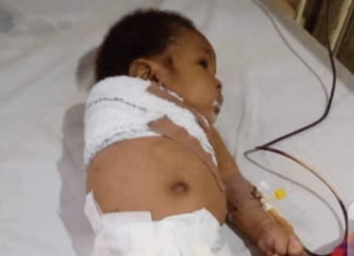 Father breaks the arm of his 2-month-old baby in Imo