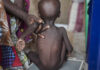 Malnutrition deficiencies affects 20.5m new babies – NESG
