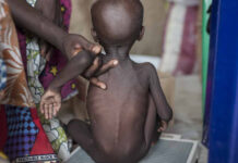 Malnutrition deficiencies affects 20.5m new babies – NESG