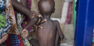 Malnutrition deficiencies affects 20.5m new babies – NESG